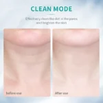 ANLAN Neck Face Beauty Device EMS Facial Neck Lifting - Image 3